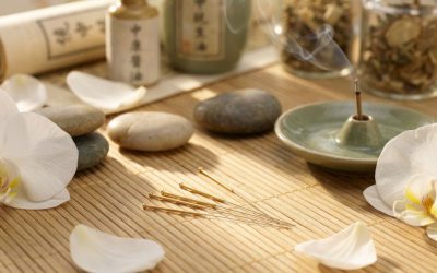 Hoe bereid ik me voor op een acupunctuurbehandeling?