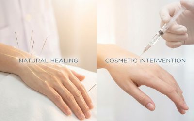 Is cosmetische acupunctuur beter dan botox?