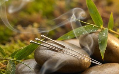 Waar kan ik acupunctuur laten doen?