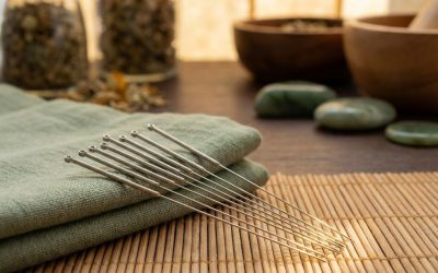 Acupunctuur Schiedam: 7 voordelen die je moet kennen