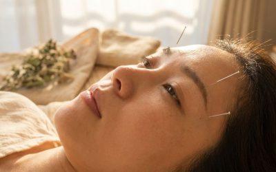 Helpt acupunctuur bij migraine en hoofdpijn?