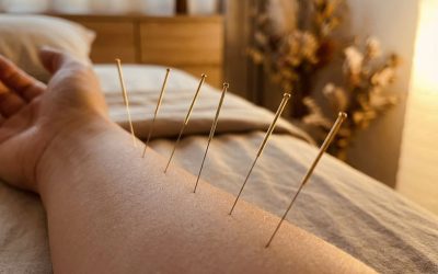 Hoe snel werkt acupunctuur bij pijnklachten?
