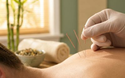 Wat maakt acupunctuur in Schiedam zo effectief?
