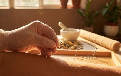 Acupunctuur in Schiedam: wat kost een behandeling?