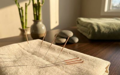 Hoe vind ik een erkende acupuncturist in Schiedam?