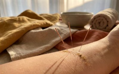 Hoe vaak heb je acupunctuur nodig?