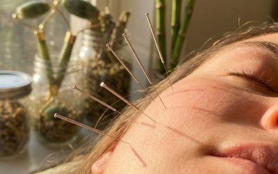 Wat zijn de voordelen van gezichtsacupunctuur?