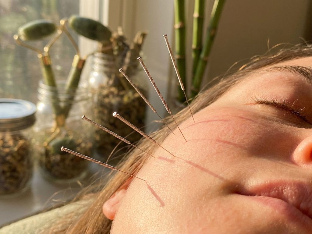 acupunctuur-gezicht-behandeling-wellness-therapie.jpg Acupunctuurbehandeling van gelaat met dunne naalden op huid, zachte gouden verlichting, traditionele geneeskunde achtergrond