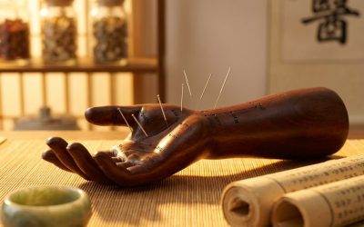 Acupunctuur Schiedam: hoeveel sessies heb je nodig?