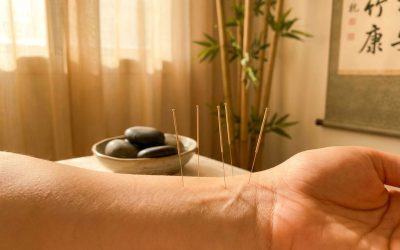 Hoe werkt acupunctuur voor anti-aging?