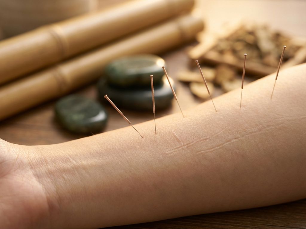 Acupunctuurnaalden geplaatst op huid tijdens traditionele Chinese geneeskunde behandeling in spa-omgeving