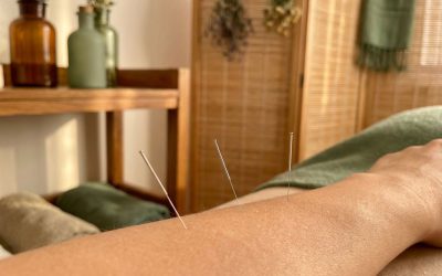 Wat moet ik verwachten bij mijn eerste acupunctuurbehandeling?