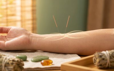 Waarom kiezen steeds meer mensen voor acupunctuur?