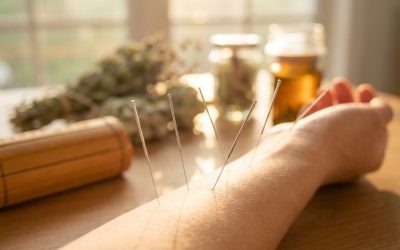 Wat zijn de voordelen van acupunctuur?