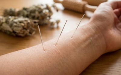 Kan acupunctuur helpen bij chronische pijn?