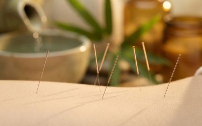 Helpt acupunctuur bij stress en burnout?
