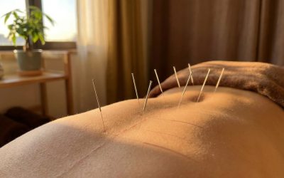 Hoe werkt acupunctuur bij pijnverlichting?