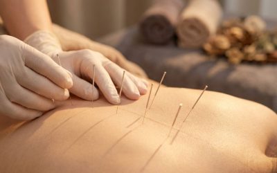 Hoe werkt acupunctuur precies?