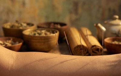 Welke acupuncturist is het beste in Schiedam?