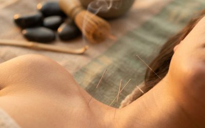 Hoe werkt acupunctuur precies in Schiedam?