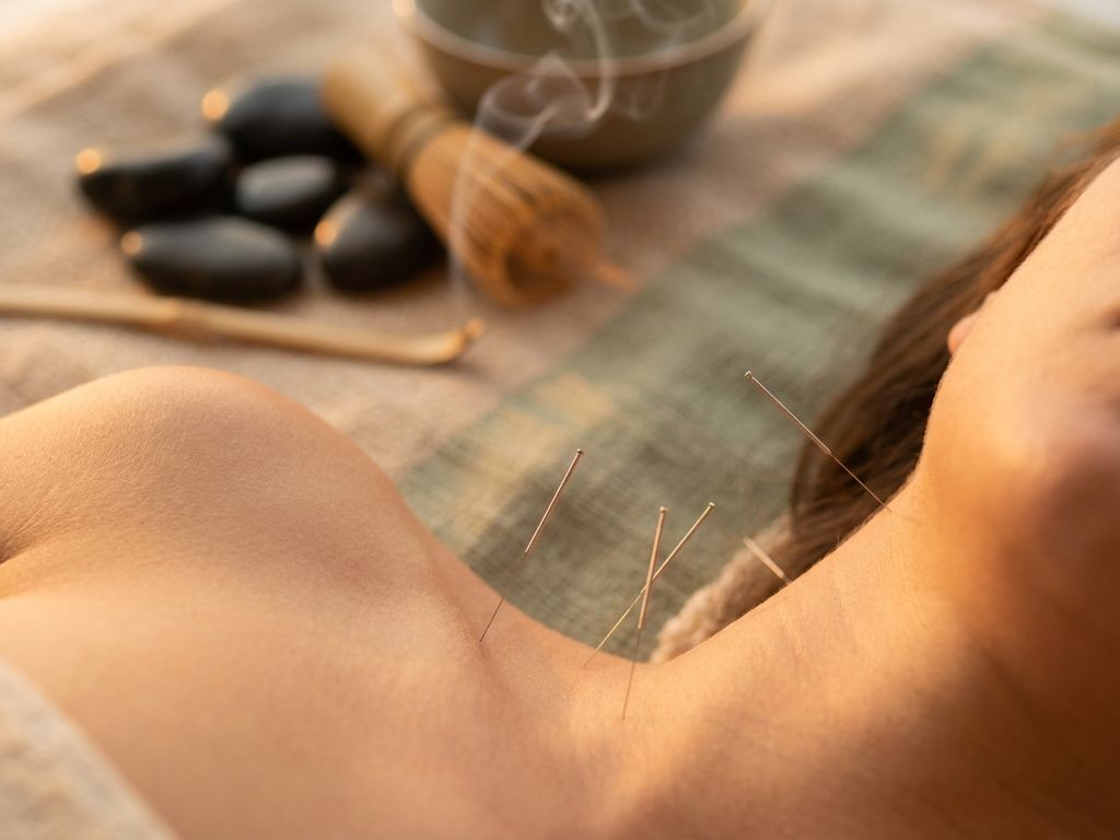 acupunctuur-naalden-traditionele-chinese-geneeskunde.jpg Acupunctuurnaalden op huid met zachte verlichting, bamboe en zen-stenen op achtergrond voor traditionele geneeskunde