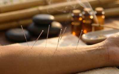 Welke voordelen heeft acupunctuur voor je gezondheid?