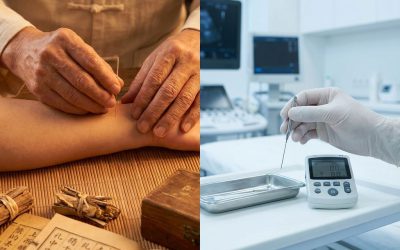 Acupunctuur in Schiedam: traditioneel vs modern