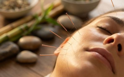 Wat is cosmetische acupunctuur?
