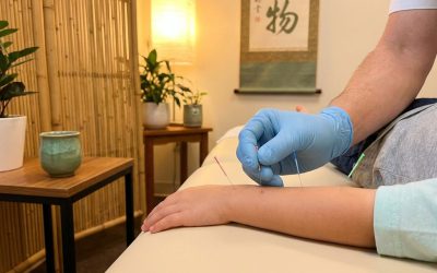 Is acupunctuur geschikt voor kinderen?